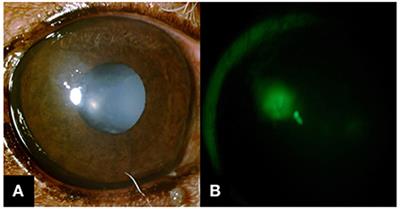 Case report: Presumed contact lens-induced intracorneal hemorrhage in a diabetic dog